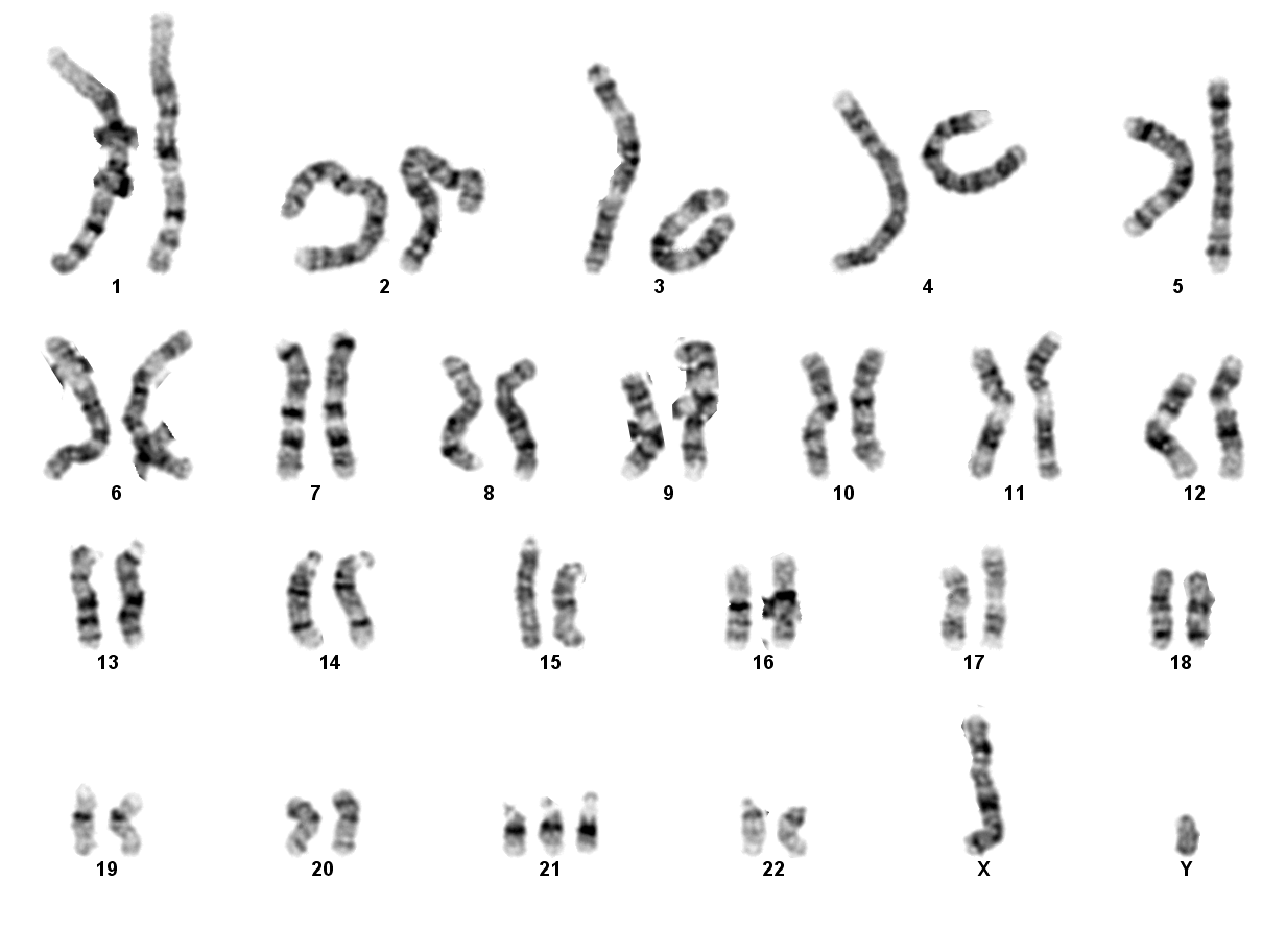 S1519413-C.P-karyogram-21